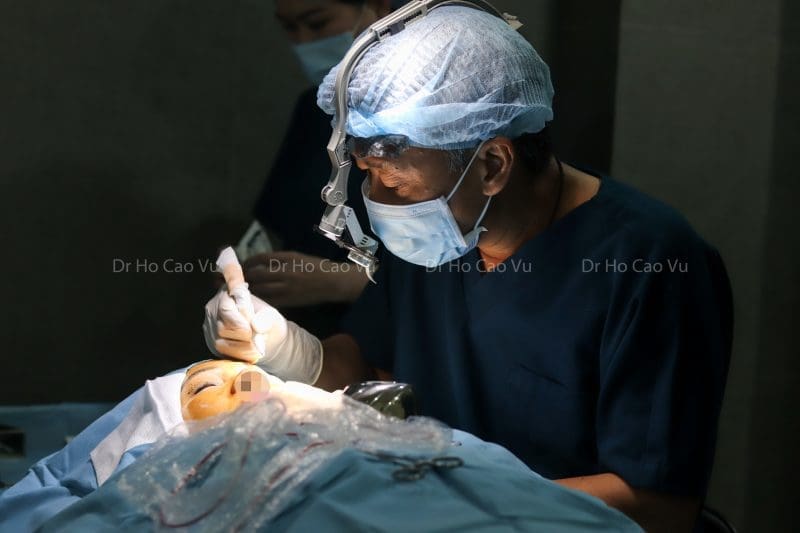 Có nhiều phương pháp điều trị phẫu thuật biến chứng lật mi sau khi lấy mỡ mí mắt trên
