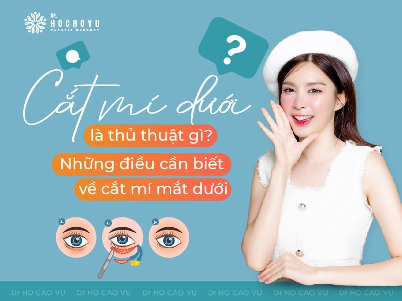 Cắt mí dưới là thủ thuật gì? Những điều cần biết về cắt mí mắt dưới