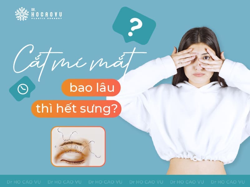 Cắt mí mắt bao lâu thì hết sưng? Lưu ý quan trọng khi cắt mí